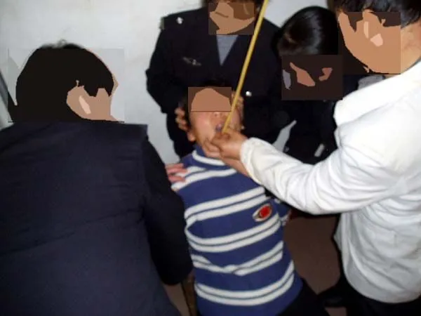 Жена е насилствено напоявана с тръба със солена вода.